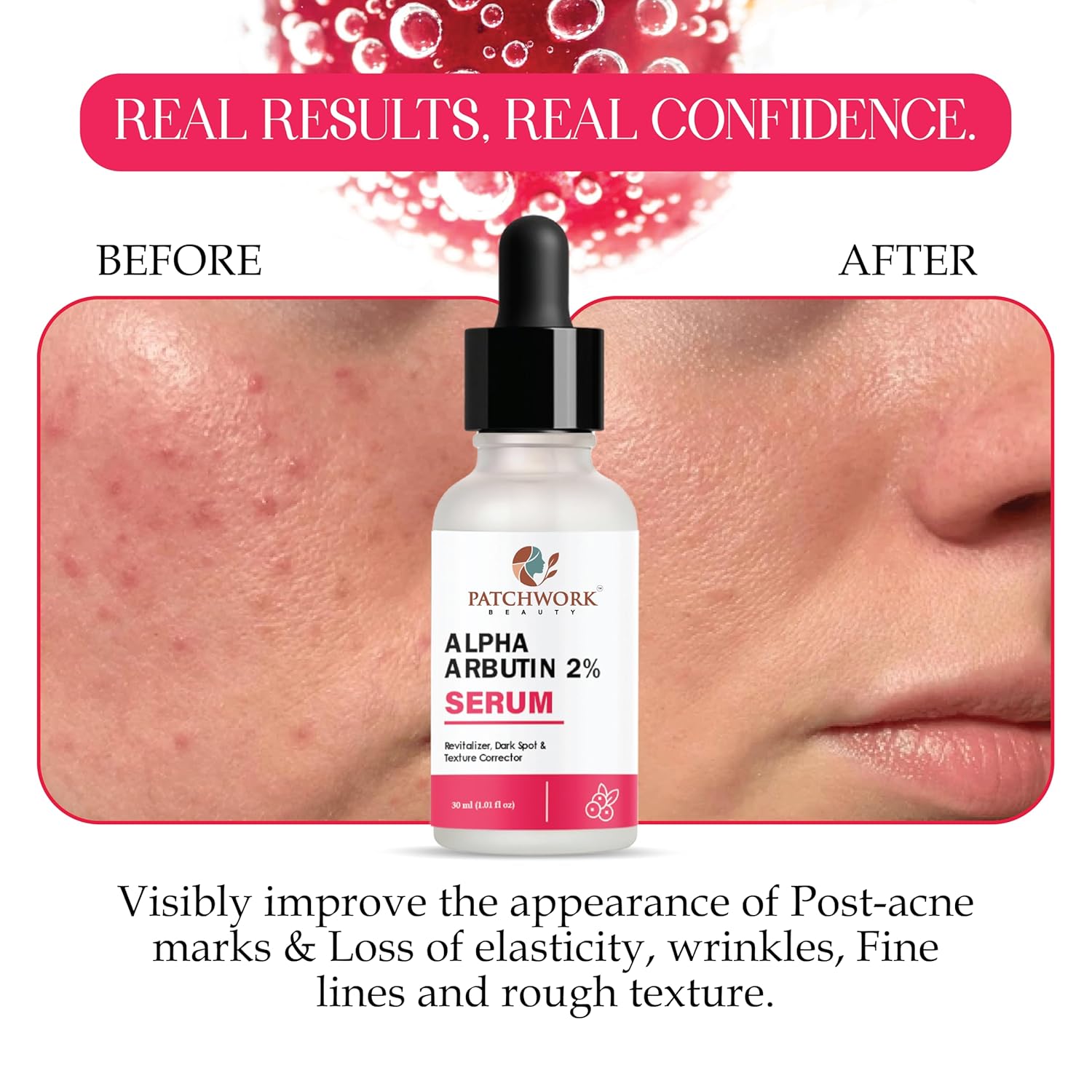 Patchwork Beauty Alpha Arbutin 2% Serum, Dark Spot Corrector and Revitalizer, 30 ml