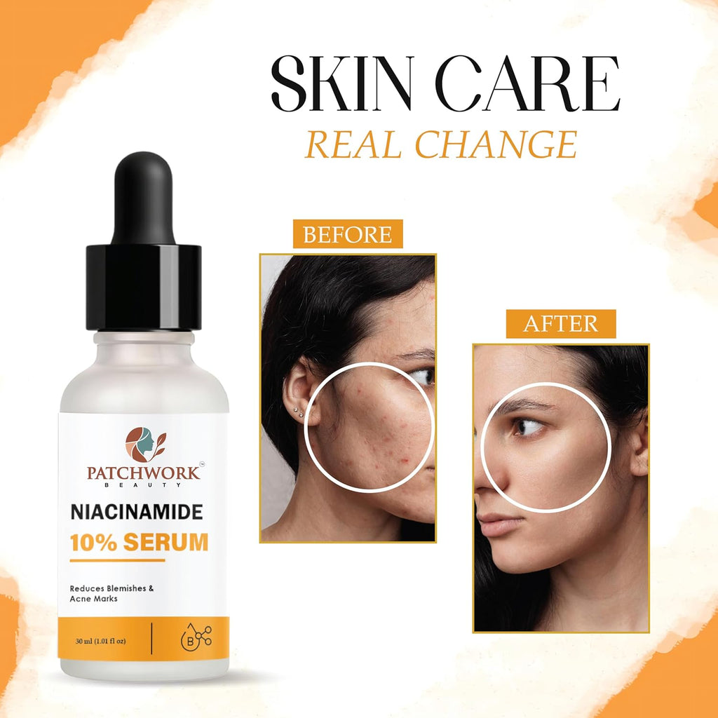 Patchwork Beauty Niacinamide 10% Serum, 30 ml, Reduces Blemishes and Acne Marks