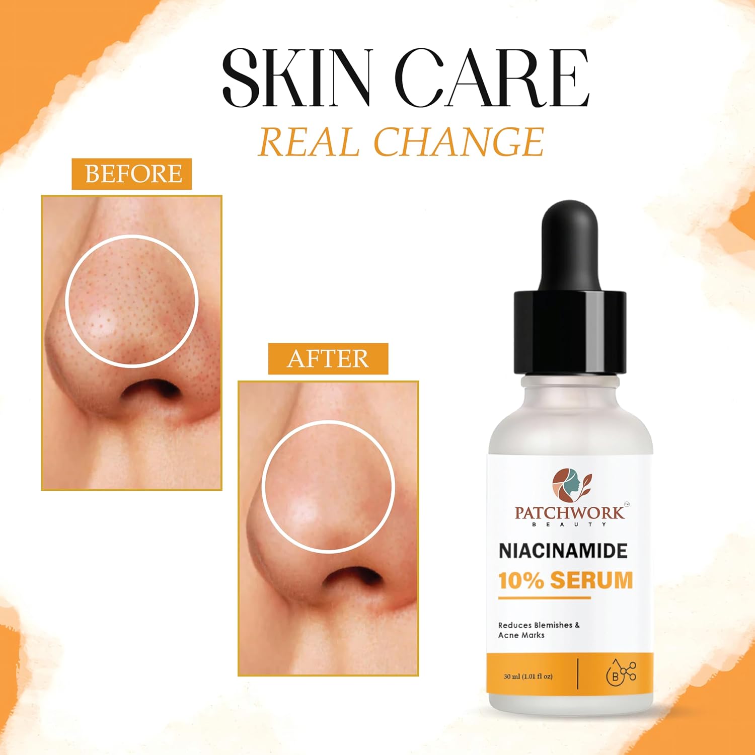 Patchwork Beauty Niacinamide 10% Serum, 30 ml, Reduces Blemishes and Acne Marks