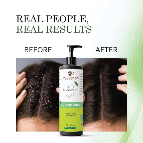 Patchwork Beauty Conditioner, Anti Hair Fall, Frizz-Free, Boosts Hair Growth, All Hair Types, 200 ml (Anti Dandruff Conditioner)